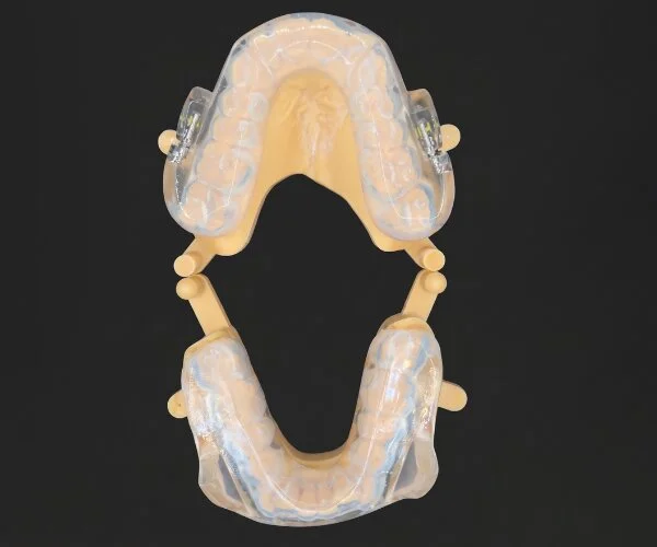 Sleep snoring dorsal image2
