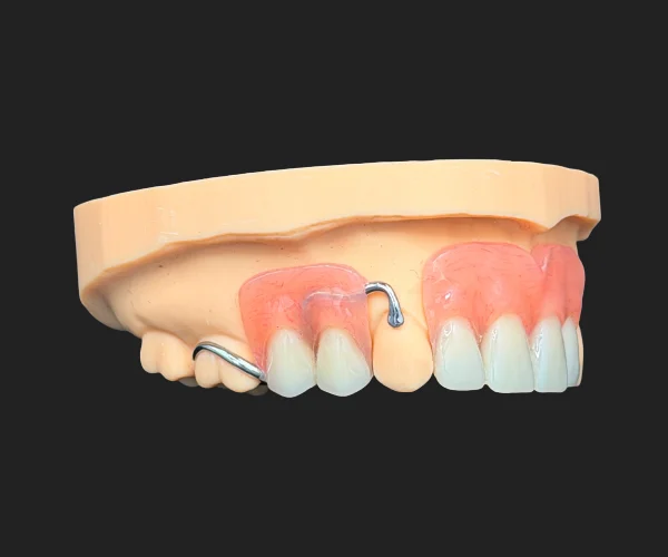 Partial and dentures acrylic partial with framework img2
