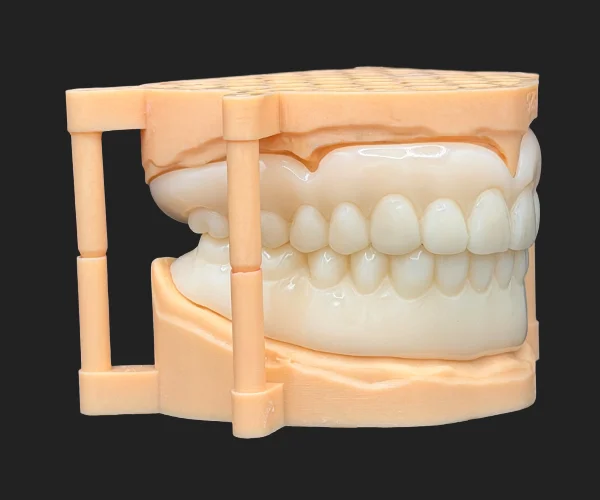 Partial and dentures printting denture img4