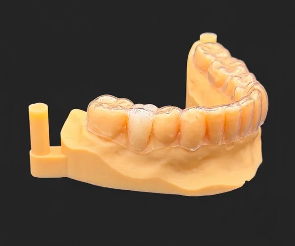 Clear aligner image1