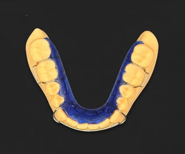 Hawley spring retainers image9