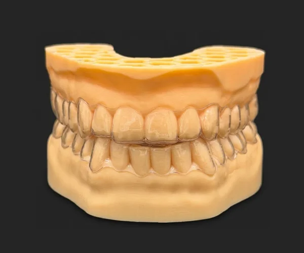 Smile aligner image1