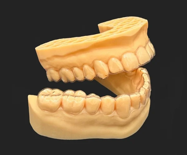 Smile aligner image2